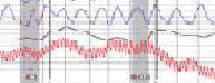 Malibu polygraph test